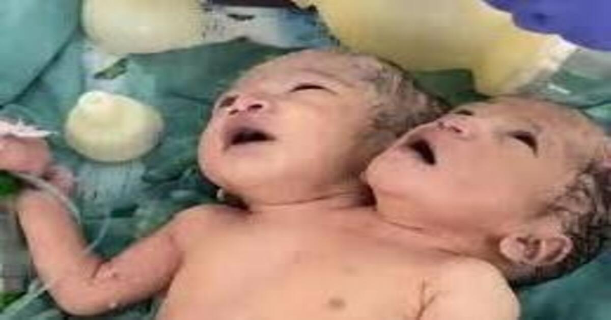 इंदौर चमत्कारी बच्ची